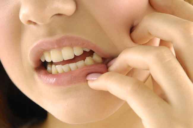 मसूढ़ों में सूजन